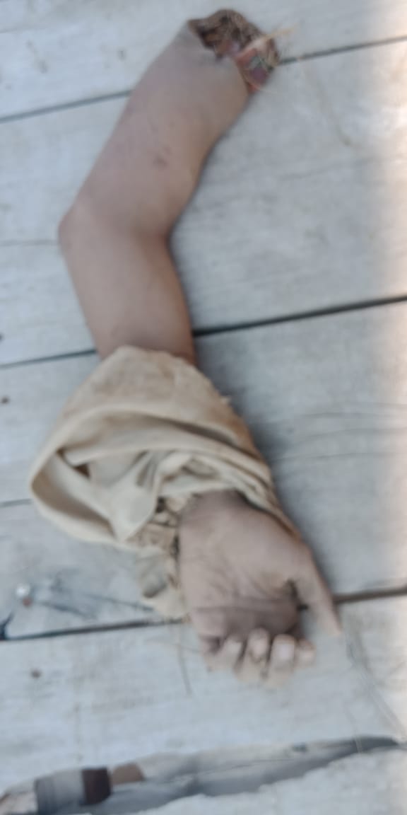 burewala human arm recovered from nearby canal